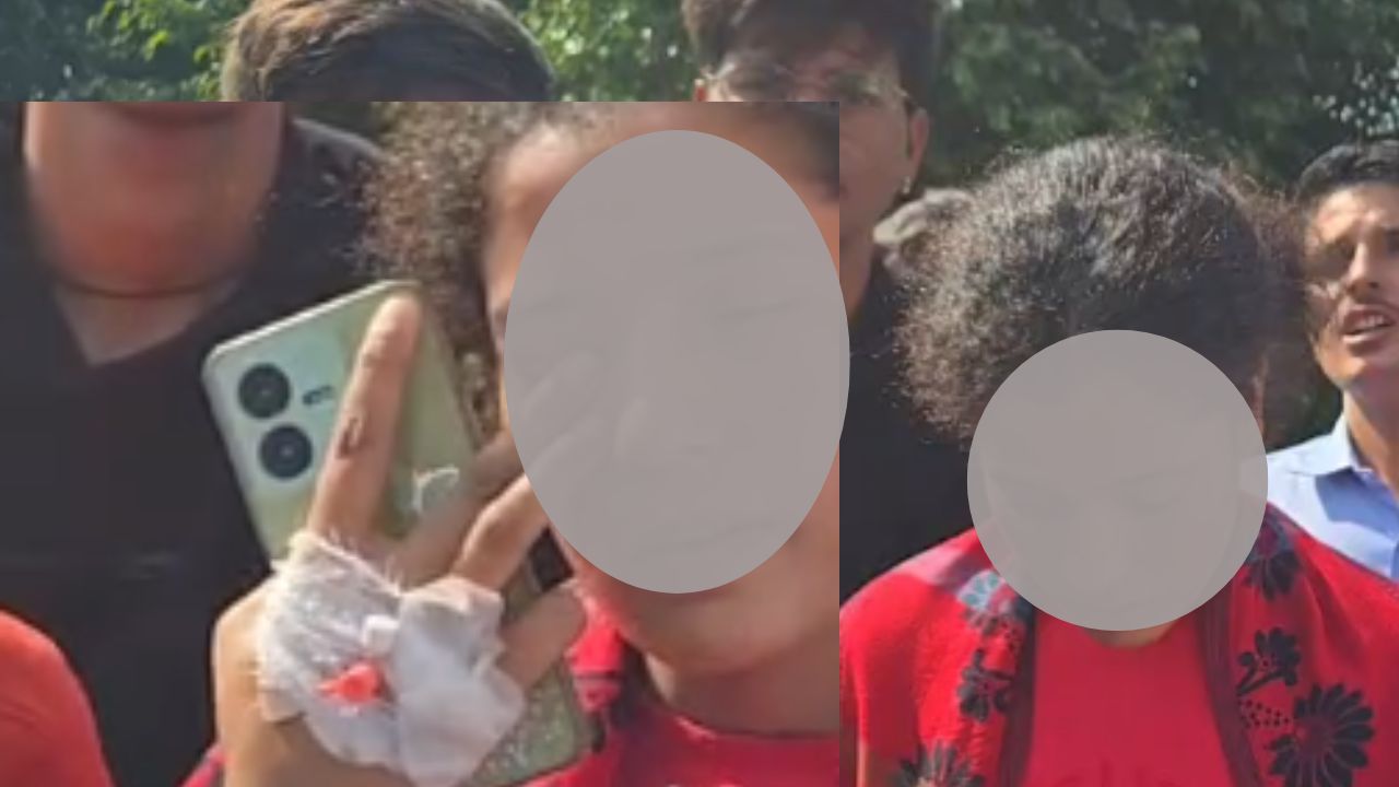 कंपनी में काम के दौरान युवती की उंगली कटी