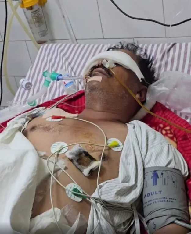 haldwani-sth-hospital-icu-bandar-chitiya-laparwahi-health-news