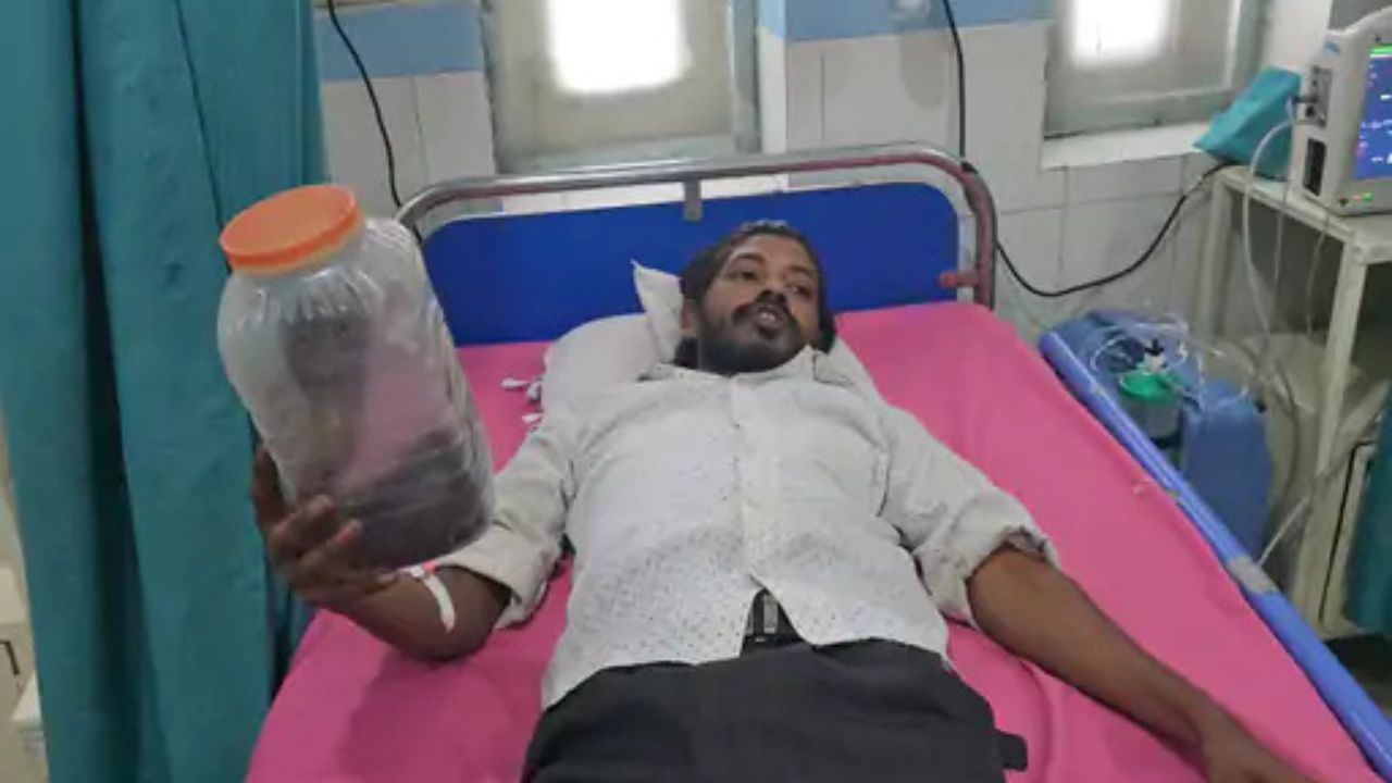 रामनगर में कोबरा के काटने के बाद डिब्बे में सांप लेकर अस्पताल पहुंचा युवक अरुण कुमार