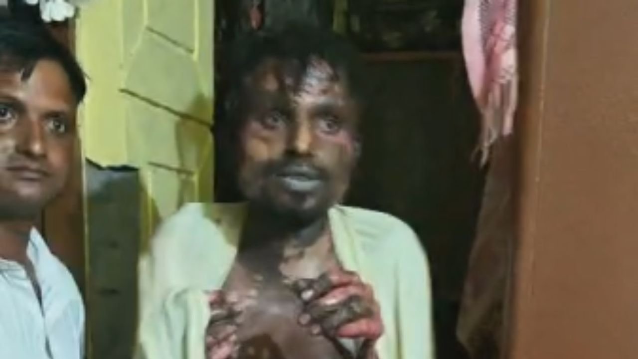 Uttarakhand Accident Concept Representing Fire Incident In Lalkuan Ghodanala